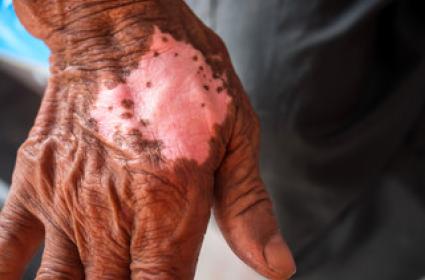 10 Arkeolojik Kazı Bulgusu 